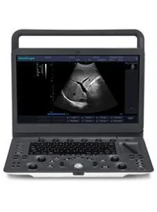 SONOSCAPE E1V ultrasound machine