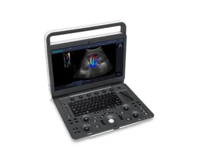 SONOSCAPE E2 Pro ultrasound machine