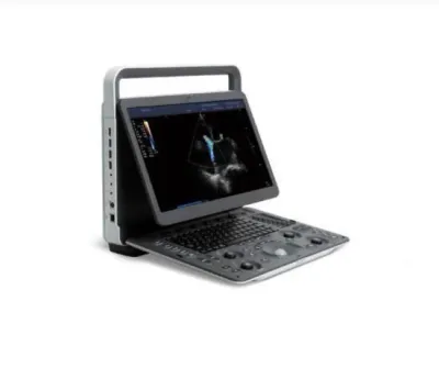 SONOSCAPE E3 ultrasound machine