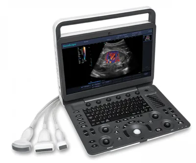 SONOSCAPE E3V ultrasound machine