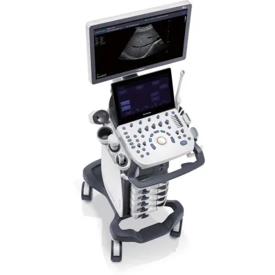 SONOSCAPE P15 ultrasound machine