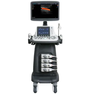 SONOSCAPE P22 ultrasound machine