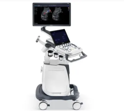 SONOSCAPE P25 ultrasound machine