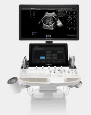 SONOSCAPE P60 Exp ultrasound machine