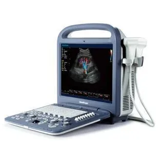 SONOSCAPE S2 ultrasound machine