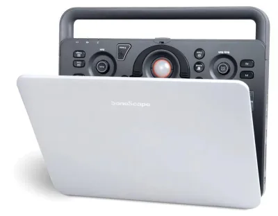 SONOSCAPE S2N ultrasound machine