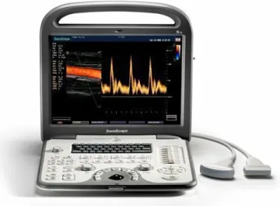 SONOSCAPE S6 ultrasound machine