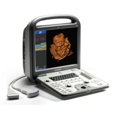 SONOSCAPE S6 pro ultrasound machine