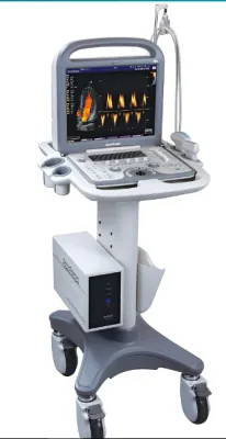 SONOSCAPE S6N ultrasound machine