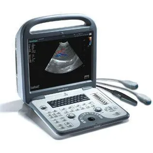 SONOSCAPE S6V ultrasound machine