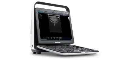 SONOSCAPE S8 ExpV ultrasound machine