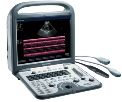 SONOSCAPE S8V ultrasound machine