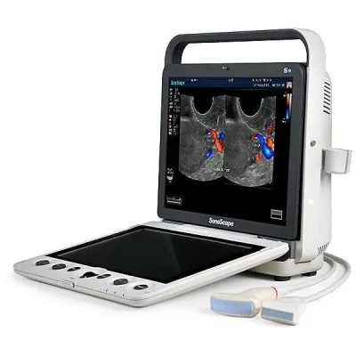 SONOSCAPE S9 ultrasound machine