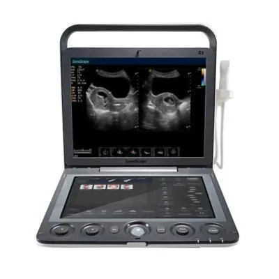 SONOSCAPE S9V ultrasound machine