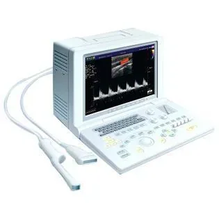 SONOSCAPE SSI-1000 ultrasound machine