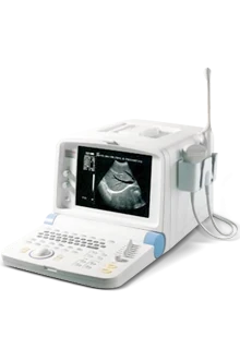 SONOSCAPE SSI-600 ultrasound machine