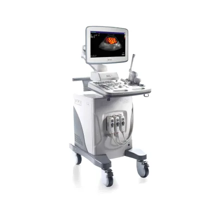 SONOSCAPE SSI-6000 ultrasound machine