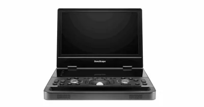 SONOSCAPE X11 ultrasound machine