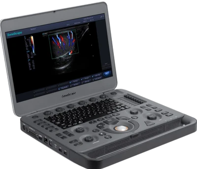 SONOSCAPE X3V ultrasound machine