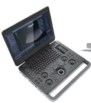 SONOSCAPE X5 ultrasound machine