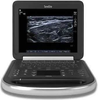 SONOSITE Edge ultrasound machine