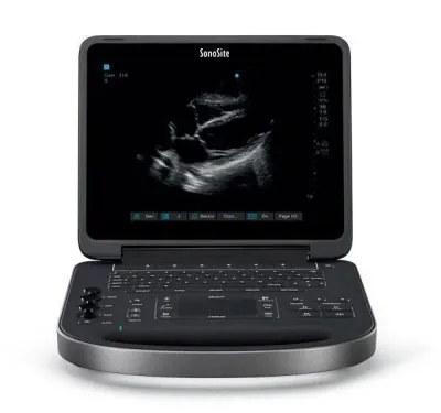 SONOSITE Edge II ultrasound machine