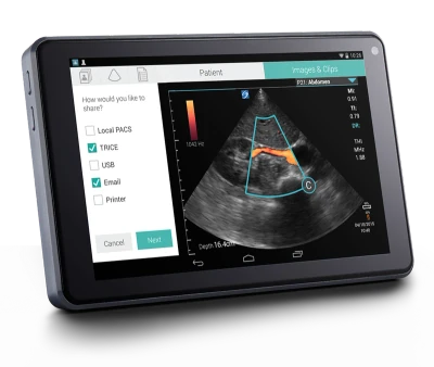 SONOSITE iViz ultrasound machine