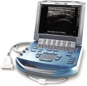 SONOSITE MicroMaxx ultrasound machine
