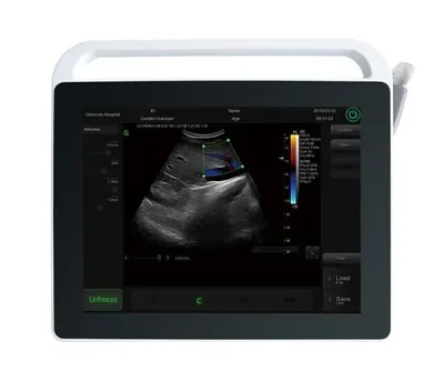 SONOSTAR C3 ultrasound machine