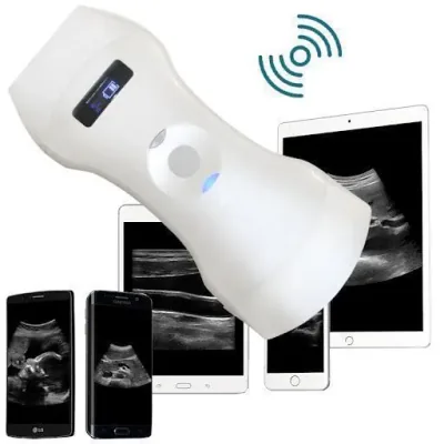 SONOSTAR C5PL ultrasound machine