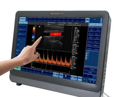 SONOSTAR C8 ultrasound machine