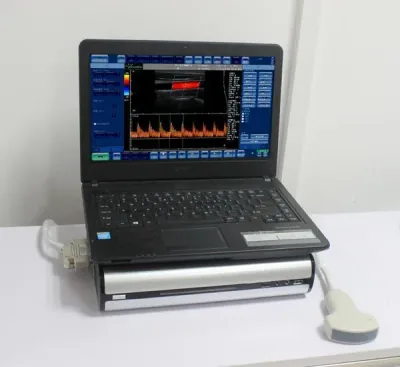 SONOSTAR CBox-3 ultrasound machine