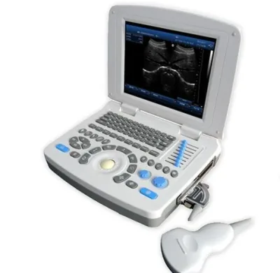 SONOSTAR SS-10 ultrasound machine