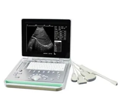SONOSTAR SS-7 ultrasound machine