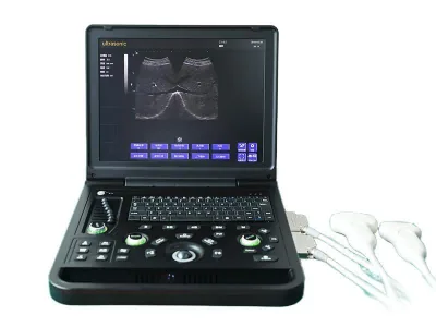 SONOSTAR SS-7C ultrasound machine