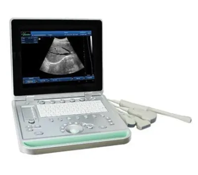 SONOSTAR SS-9 ultrasound machine