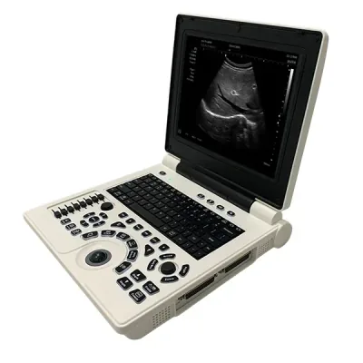 SONOSTAR SS-9B ultrasound machine