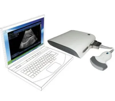 SONOSTAR UBox-10 ultrasound machine