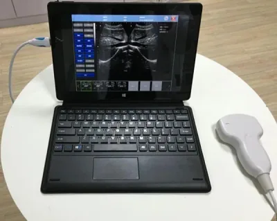 SONOSTAR UPad-10 ultrasound machine