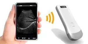 SONOSTAR UProbe-2 ultrasound machine