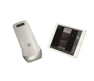 SONOSTAR UProbe-2B ultrasound machine