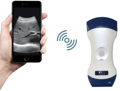 SONOSTAR Uprobe-C5LC ultrasound machine