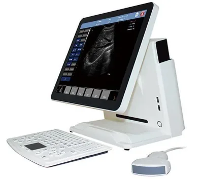SONOSTAR UTouch-10 ultrasound machine