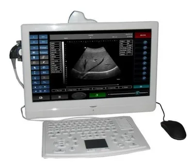 SONOSTAR Utouch-8 ultrasound machine