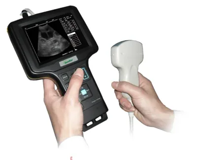 SONOSTAR V6 ultrasound machine
