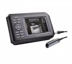 SONOSTAR V7 ultrasound machine