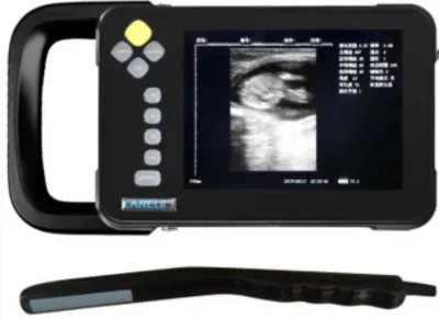 SONOSTAR V8 ultrasound machine