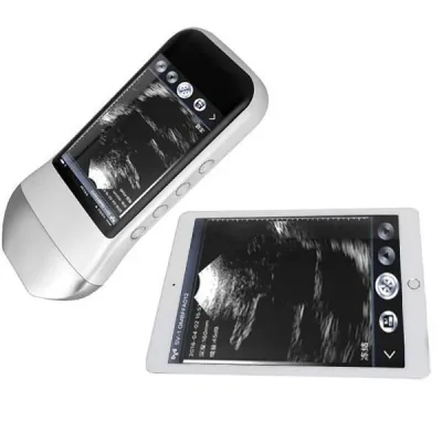 SONOSTAR XProbe-5N ultrasound machine