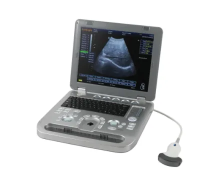 SUNBRIGHT SUN-800D ultrasound machine