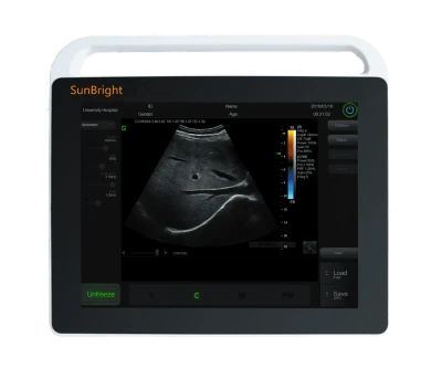 SUNBRIGHT SUN-800S ultrasound machine